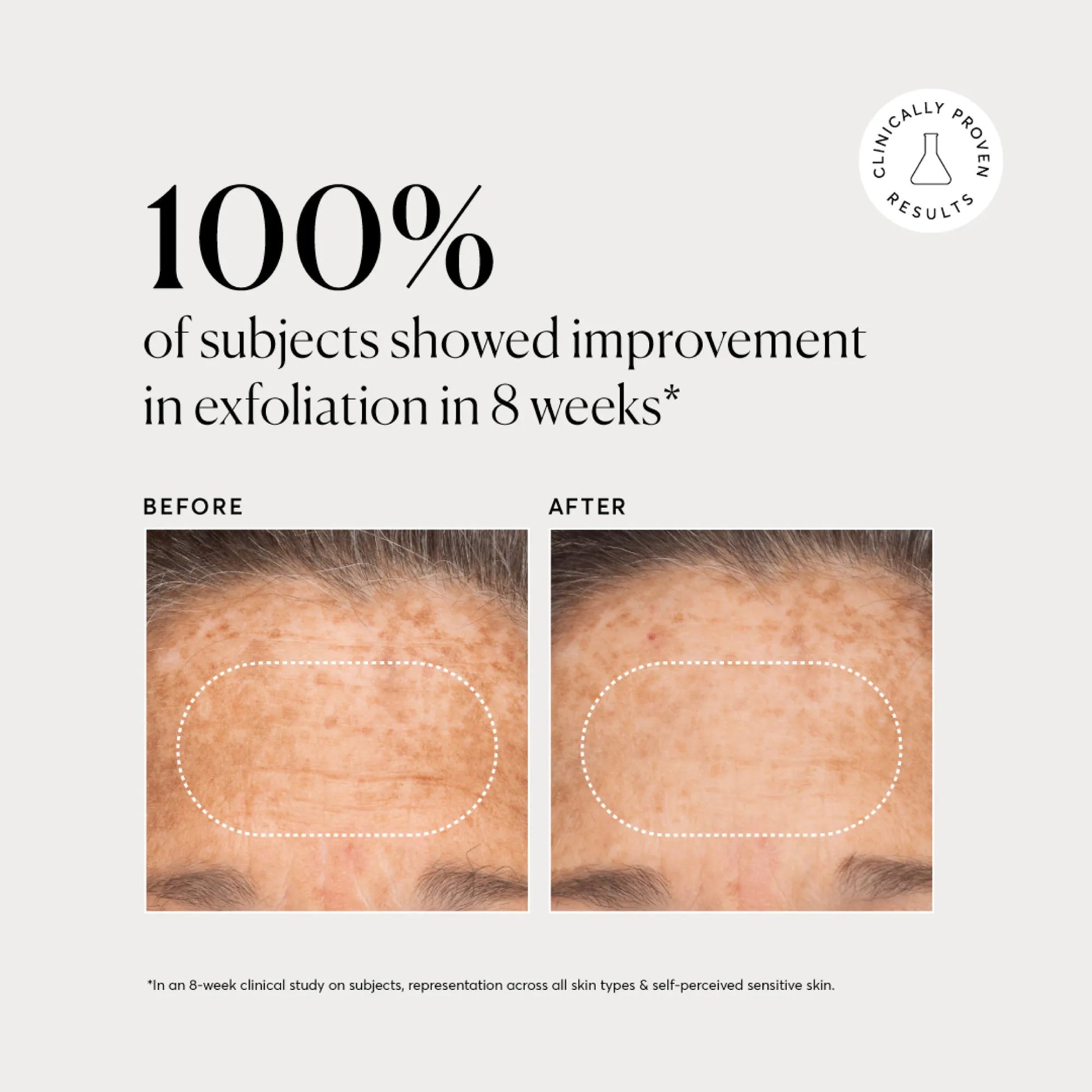 bha-liquid-exfoliant-2-k5 NATR-10027-Alt-Images-BHA-Liquid-Exfoliant-2_-03.webp