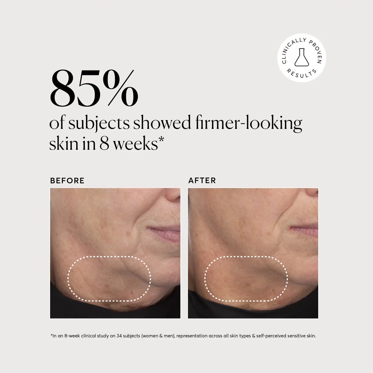 retinol-complex-serum-d0 NATR-10034-Alt-Images-Retinol-Complex-Serum-04.webp